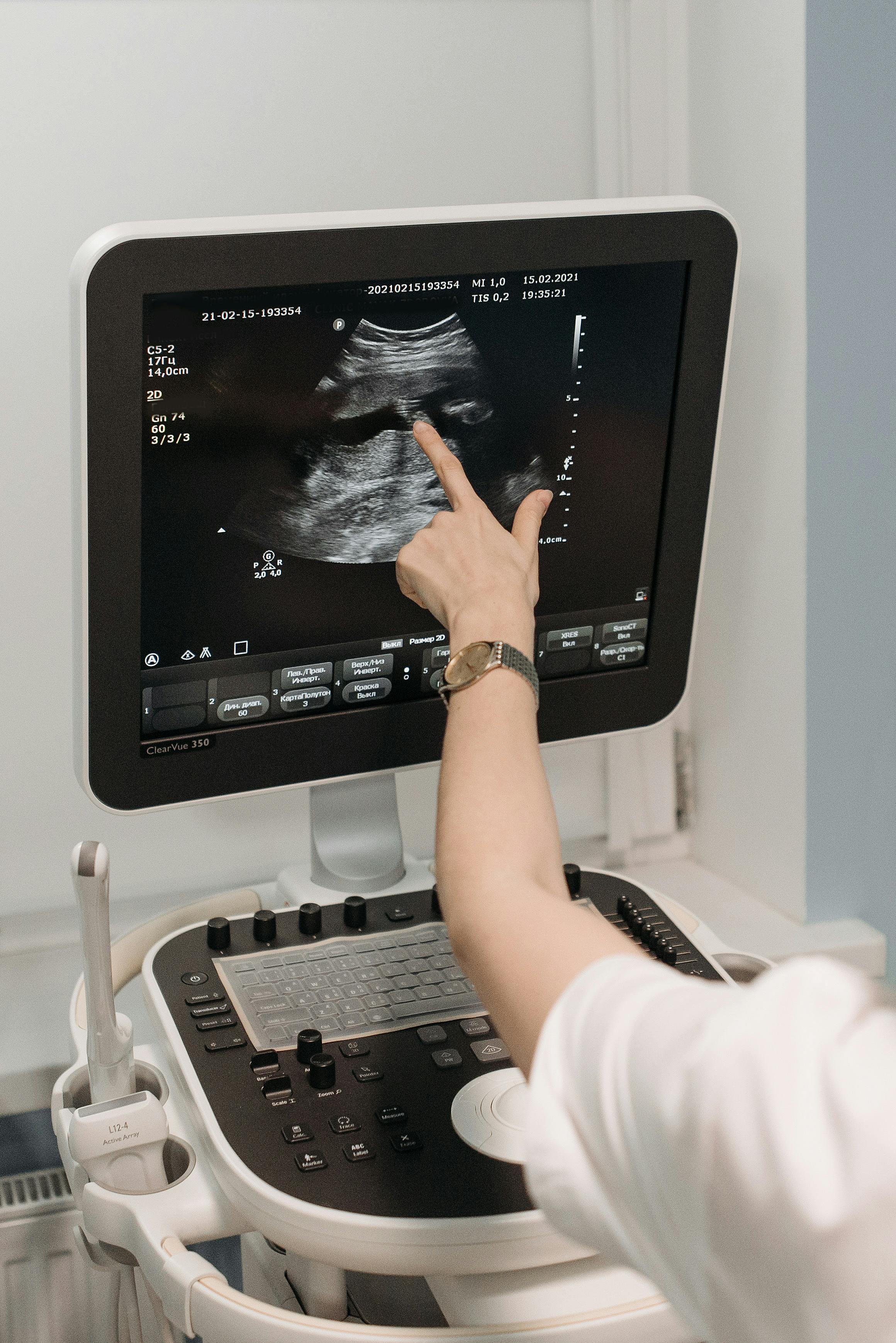 Sonography Service